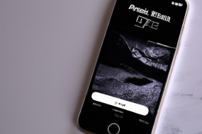 Why Apple iOS is Better Than HarmonyOS: A Comprehensive Comparison
